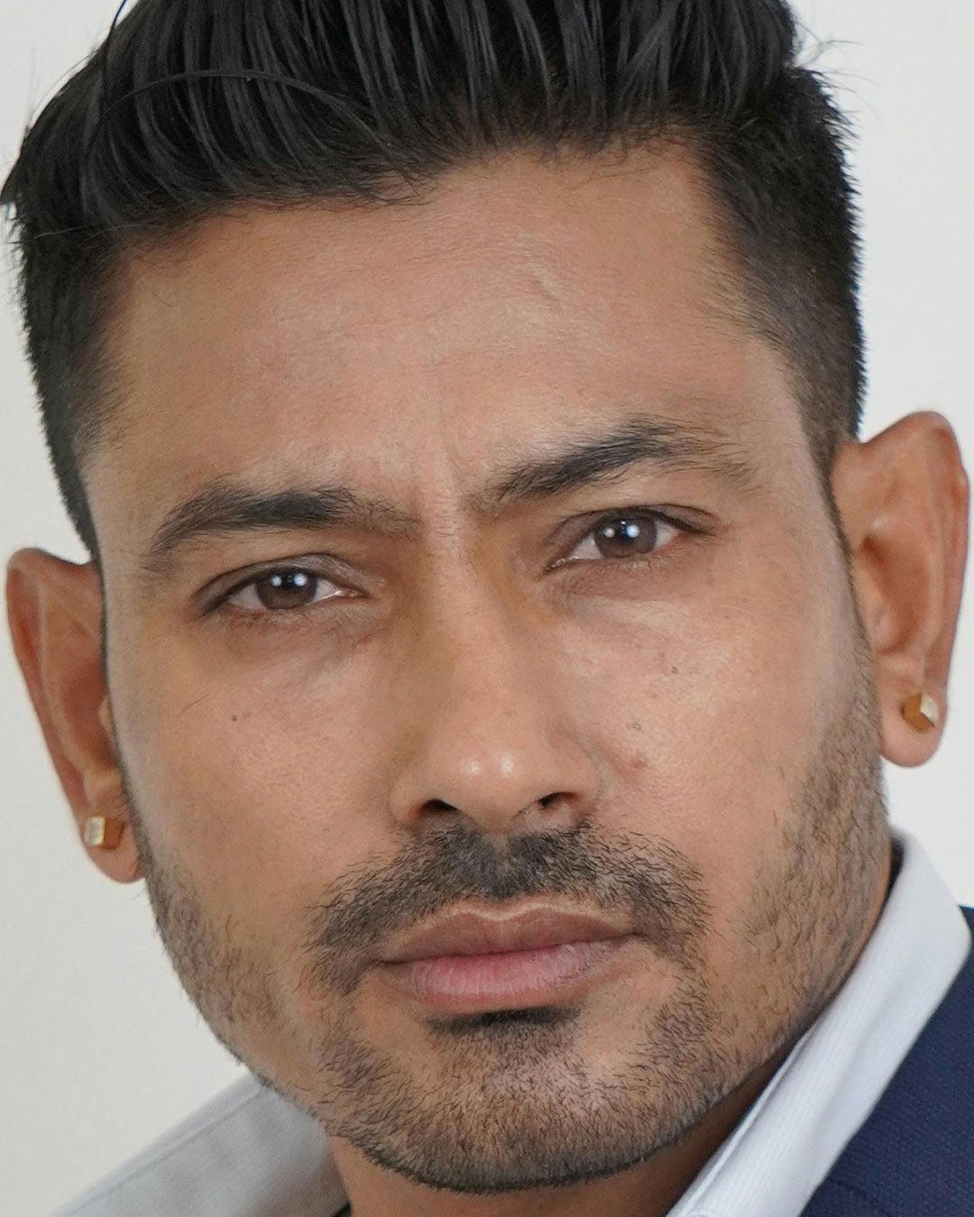 Masculinización facial prótesis