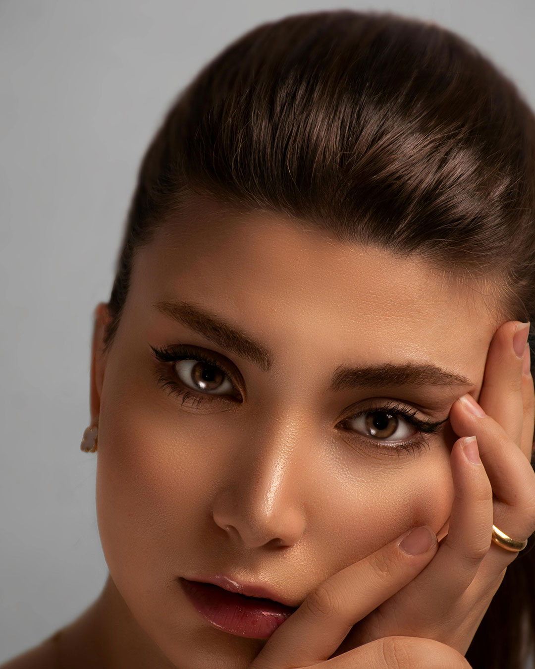 Blefaroplastia superior láser