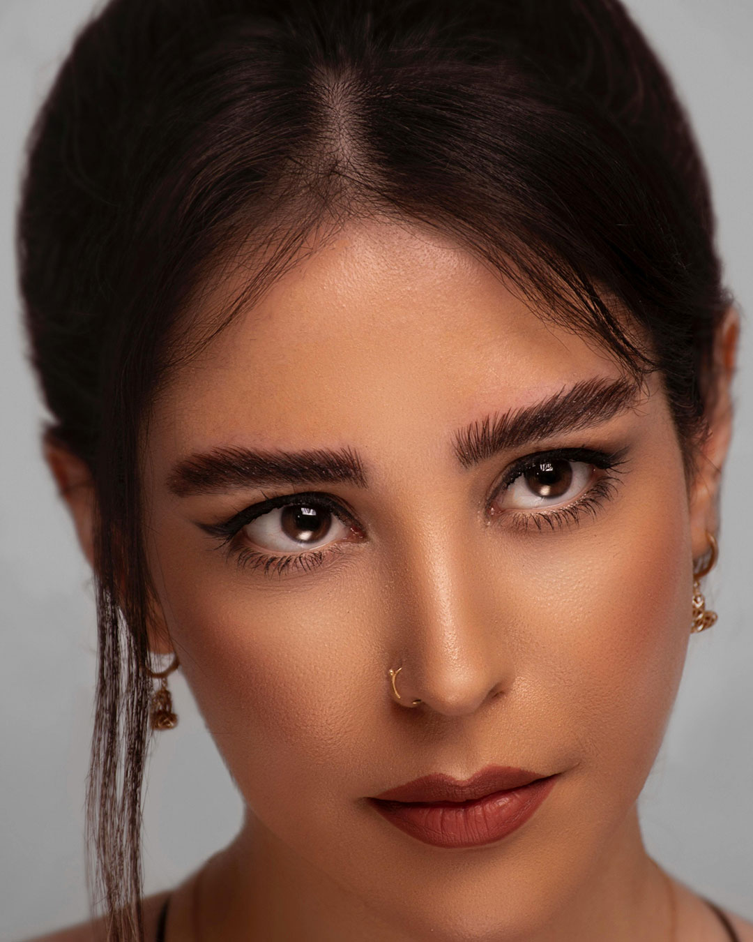 Blefaroplastia inferior láser