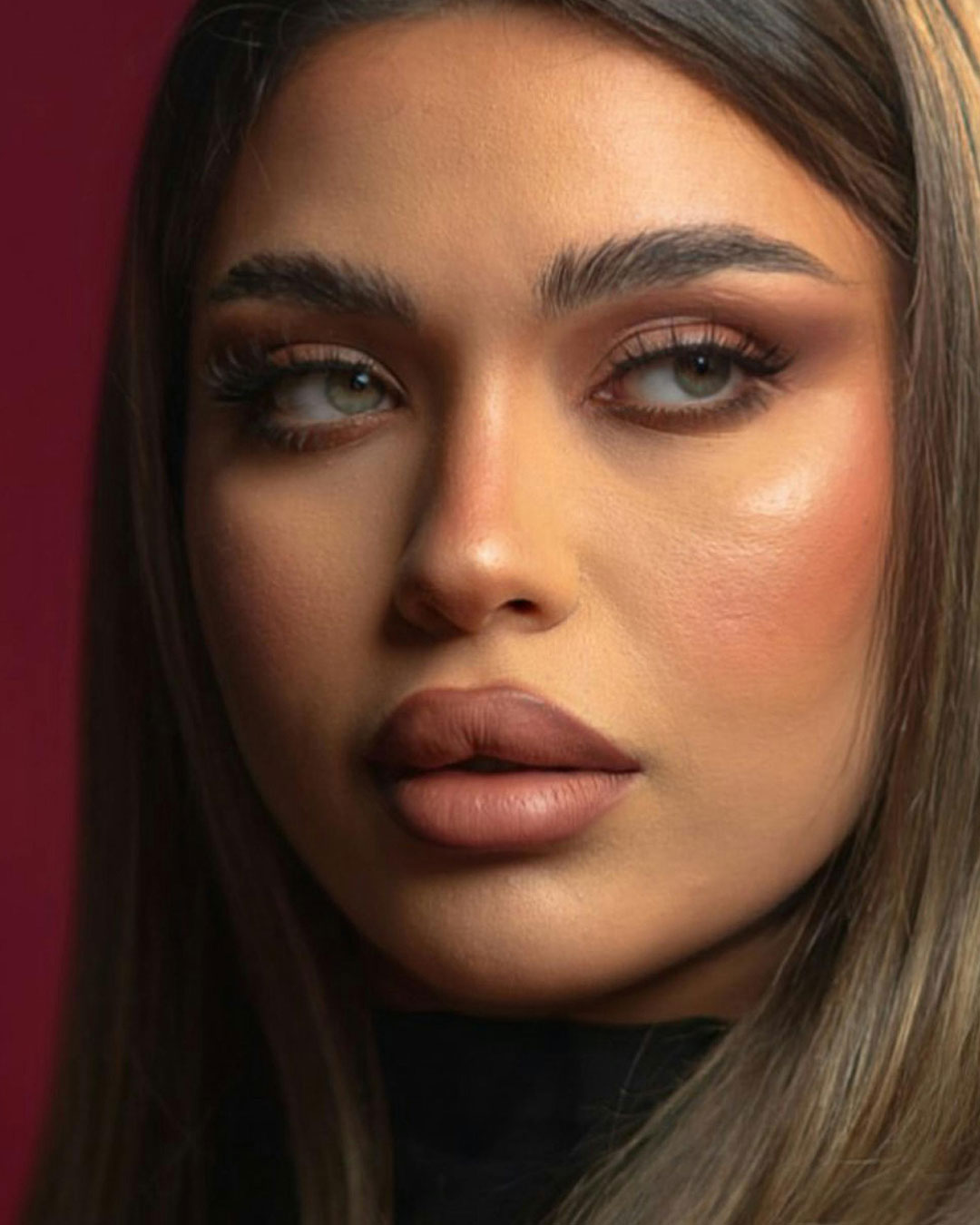 Líp lifting láser (cirugía de aumento de labios definitivamente)