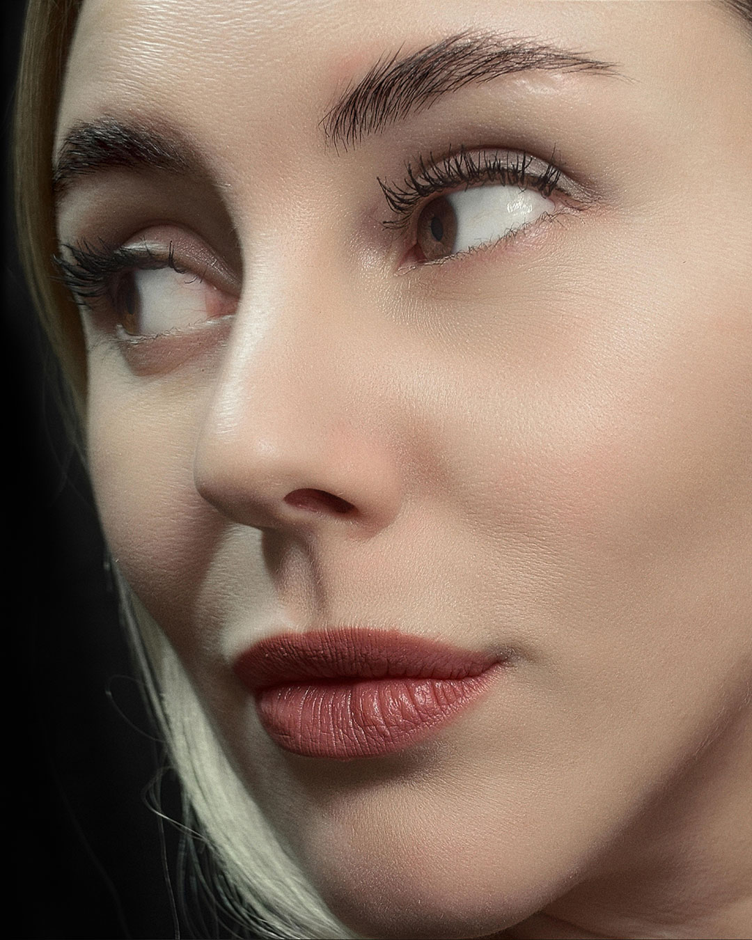 Eliminación de arrugas con Botox